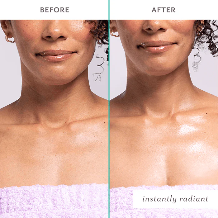 Firm Believer Neck & Décolleté Treatment - Patchology