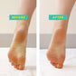 PoshPeel Exfoliating Foot Peel Treatment - Patchology
