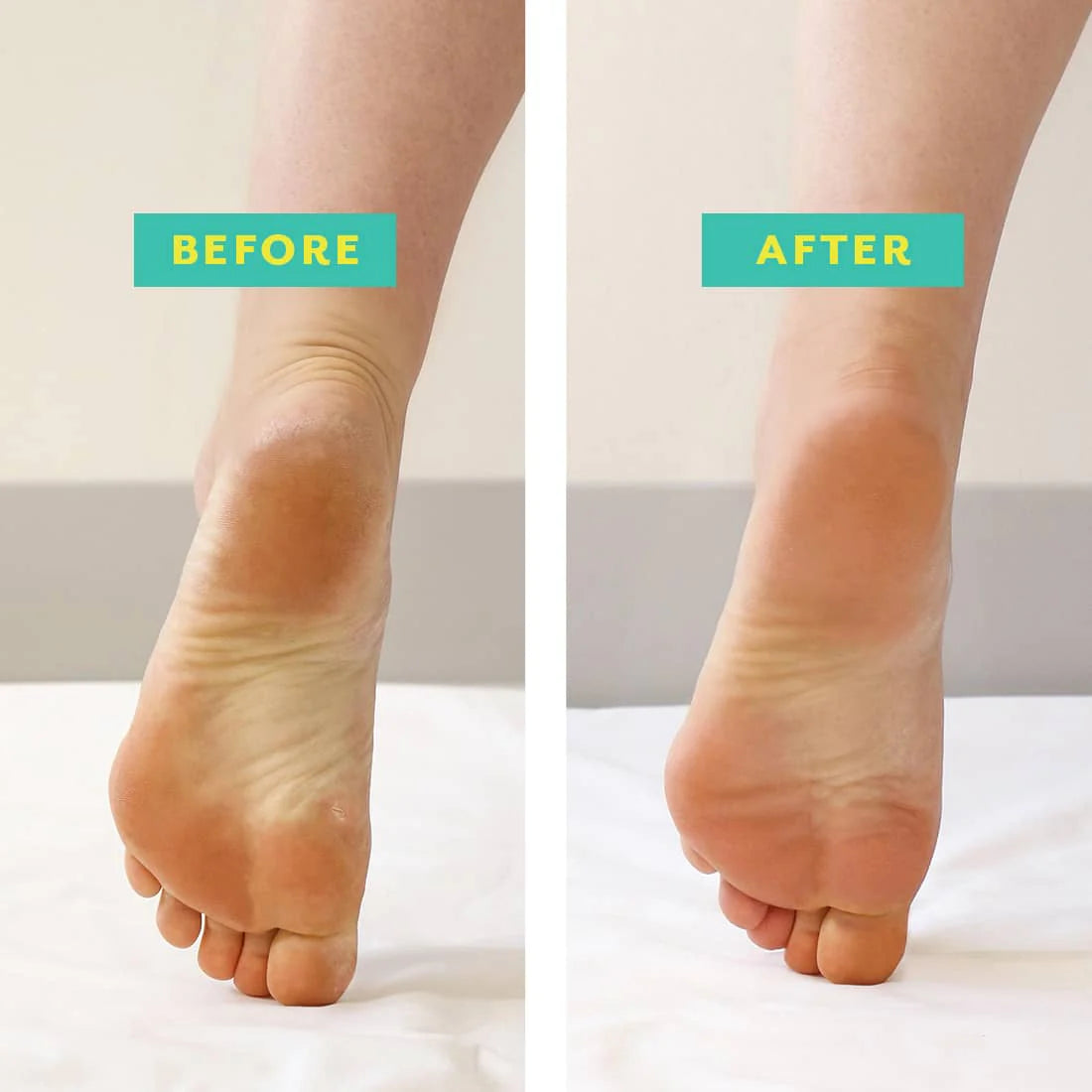 PoshPeel Exfoliating Foot Peel Treatment - Patchology